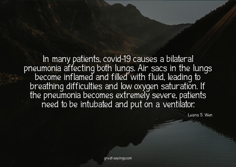 In many patients, covid-19 causes a bilateral pneumonia